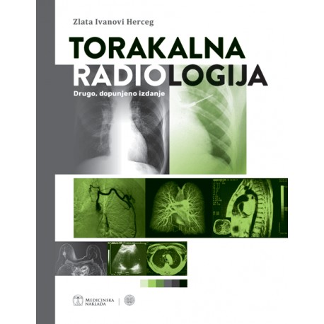 TORAKALNA RADIOLOGIJA drugo, dopunjeno izdanje